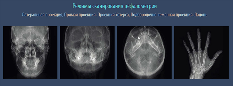 Режим сканирования цефалометрии.jpg