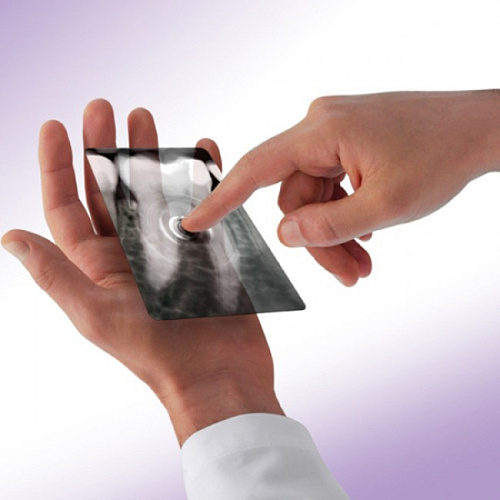 MyRay X-pod - беспроводная цифровая радиовизиографическая система