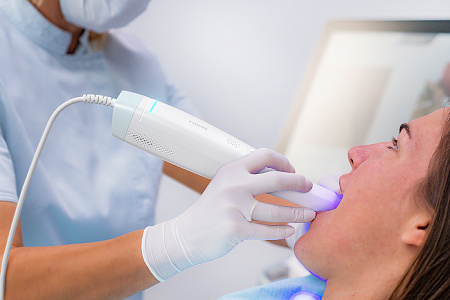 Ray RAYiOS 2 – Стоматологический интраоральный 3D-сканер