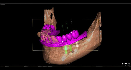 Owandy I-Max Touch 3D – Конусно-лучевой томограф 9х8