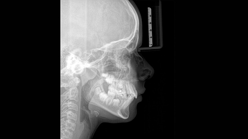 Sirona Orthophos SL 3D (11x10) – Дентальный томограф